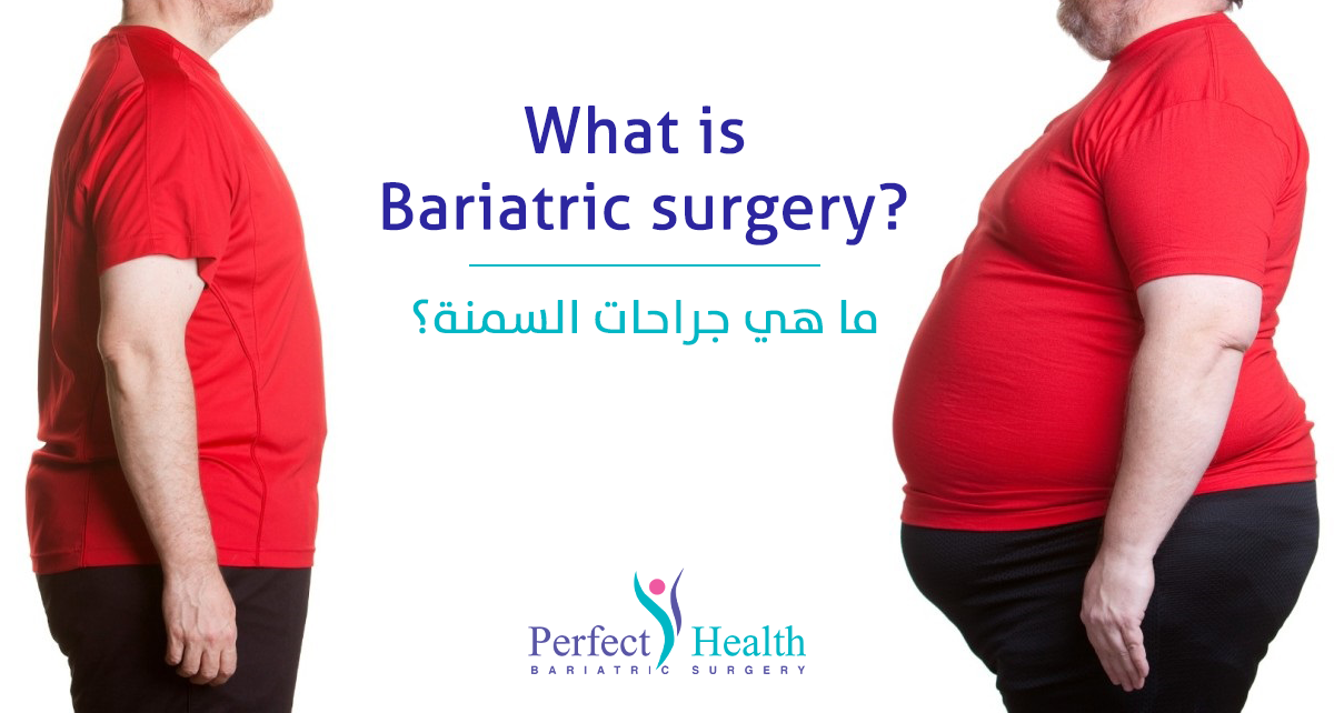 Bariatric surgery in Egypt