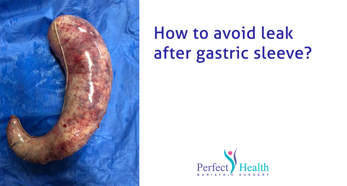 How to avoid leak after gastric sleeve?